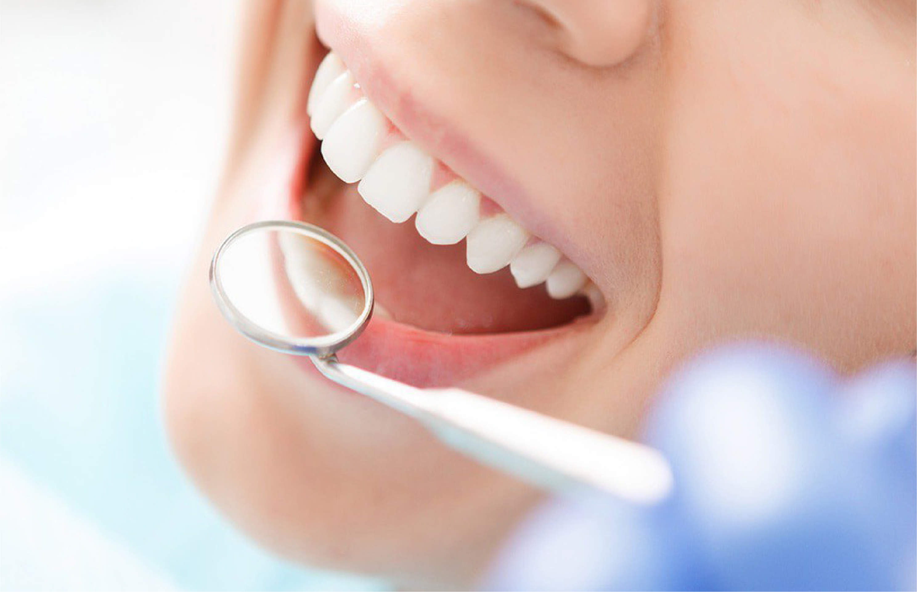 Diş Eti Sorunlarına Yenilikçi Bir Çözüm: Guided Biofilm Therapy® Tedavi Protokolü